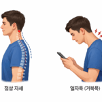 📌 일자목, 단순 자세 문제가 아닙니다